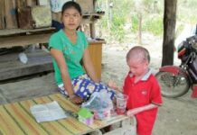 Help Sought For Disfigured Child