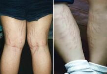 Thai FDA Warns Of Hazardous Whitening Products