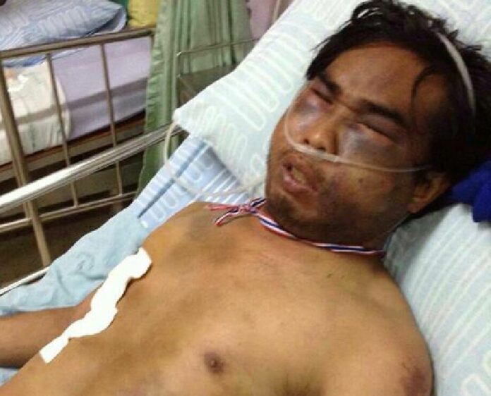 Picture of Mr. Yuem Villa in Bang Pakong Hospital as provided by the police.