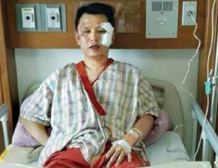 Col. Witthawat Wattanakul shortly after he was attacked by anti-government protest guards (image provided by the police)