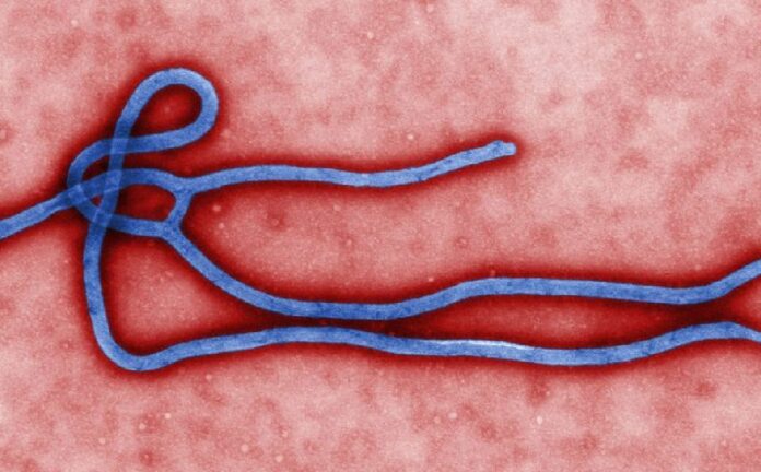 Microscopic image of Ebola virus (Wikipedia file photo)