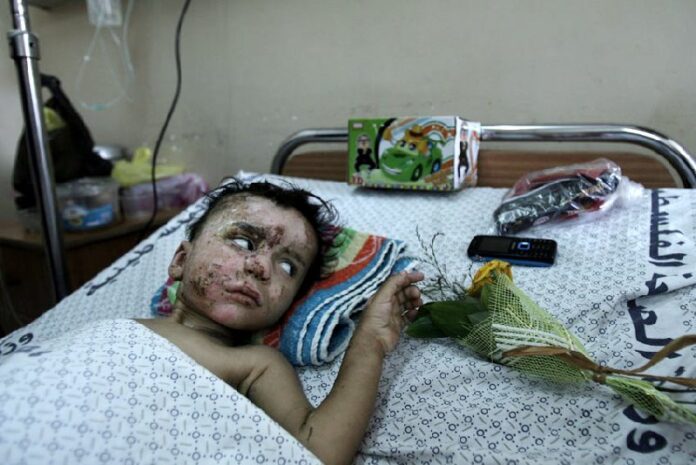 On 12 August, 18-month-old Mohammed Ali Wahdan lies on a cot in the paediatric ward of Al-Shifa Hospital, in Gaza. He is recovering from burns and injuries he sustained during a blast that reportedly killed 12 members of his family, including his mother. Photo: UNICEF/NYHQ2014-1159/El Baba<br />