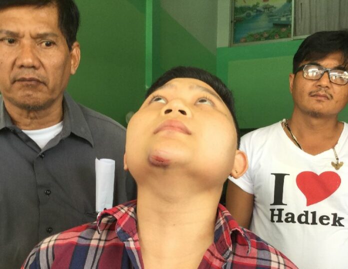Neranchala Petchploy, 21, shows her injuries to the press, 9 March 2015.