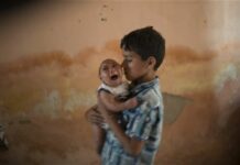 Zika Virus Linked to Rising Birth Defects