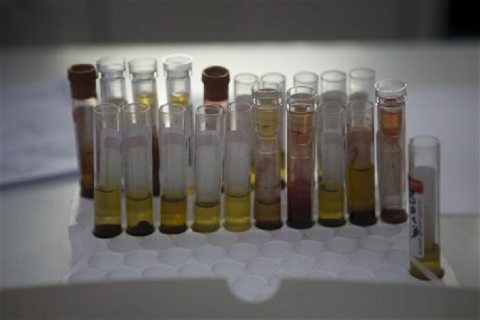 Blood samples from pregnant women wait to be analyzed for the presence of the Zika virus at a hospital in Guatemala on Tuesday. Photo: Moises Castillo / Associated Press<br />