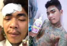 Police Find No Evidence Net Idol Shot Himself on Facebook Live